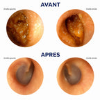 Avant et après : les deux conduits vus à la caméra